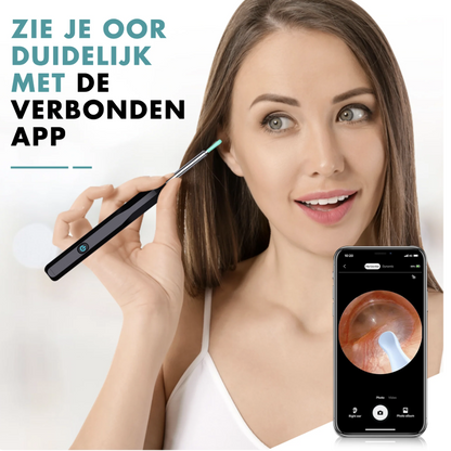 EarScope Vision - Oorsmeer Verwijderaar