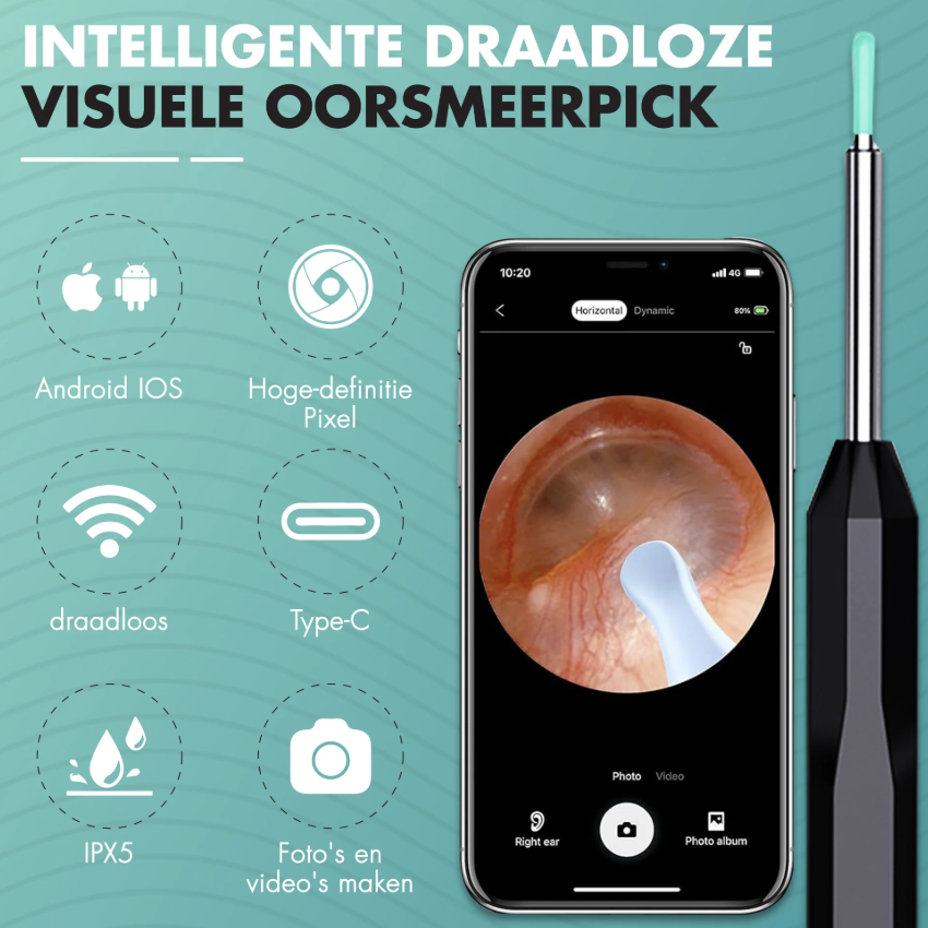 EarScope Vision - Oorsmeer Verwijderaar