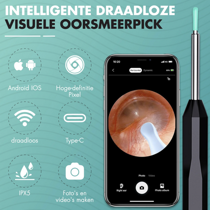 EarScope Vision - Oorsmeer Verwijderaar