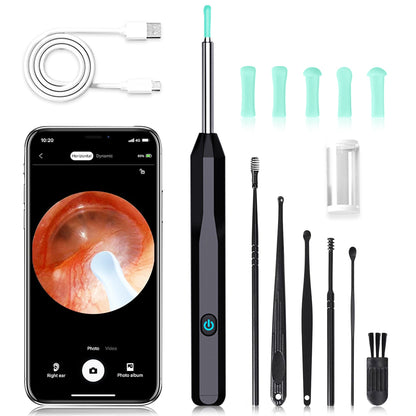 EarScope Vision - Oorsmeer Verwijderaar