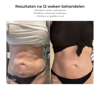 Contoura CelluSmooth - Massage apparaat