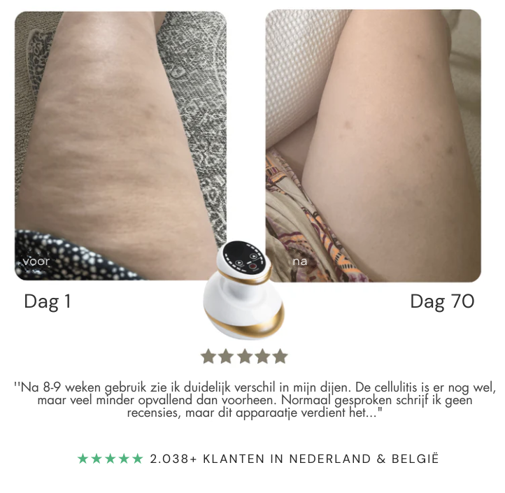 Contoura CelluSmooth - Massage apparaat