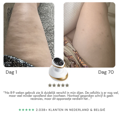 Contoura CelluSmooth - Massage apparaat